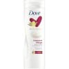 Dove Body Lotion Intensive Zeer Droge Huid